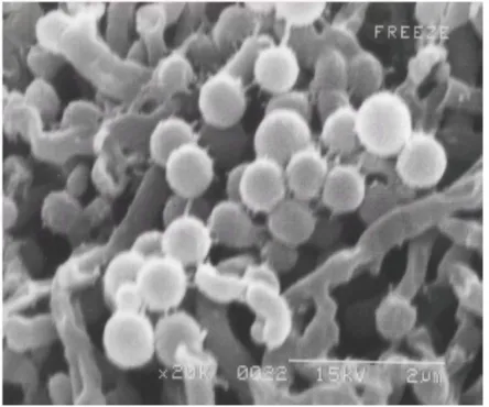 Fig. 4: The scanning electron micrograph of strain BTG10-2 on ISP2 medium (21 days).