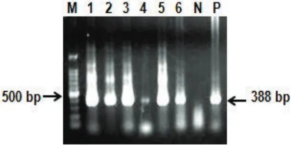 Fig. 2. Agarose gel electrophoresis of PCR product. M-100 bp ladder; 1-6 samples were positive for TBEV, N-negative control, P-positive control.