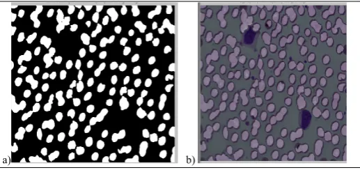 Figure 4.  a) Segmented WBC nucleus b) RBC segmentation from the elimination of WBC nucleus and small particles