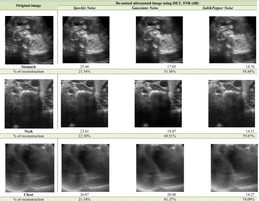 Figure 2.  De-noised of ultrasound images using HET algorithm 