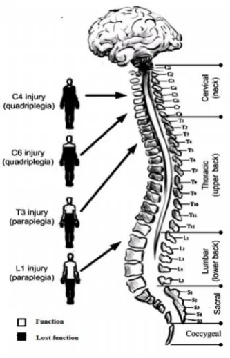 Figure 5: Effects of SCI depend on the type and level of the injury