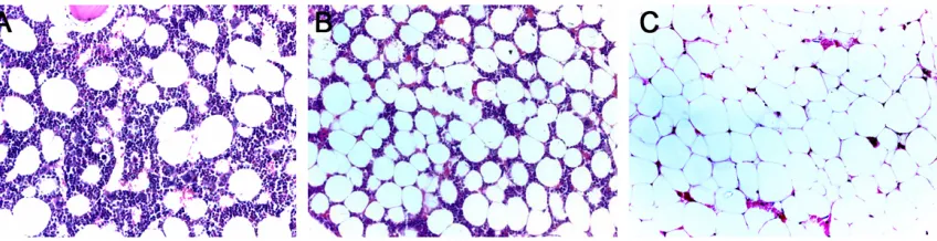 Figure 4. Number of adipocytes with different sizes in bone marrow. The majority of adipocytes had small diameter at the early stage and had large diameter at the late stage