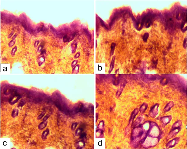 Fig. 6: Hair follicles in the skin of white rats: a – 1st group; b – 2nd group; c – 3rd group; d – 4th group