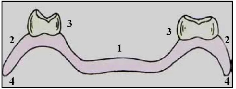 Figure 2.2: Surface parts of a complete denture (1) Denture base (2) Denture flange 