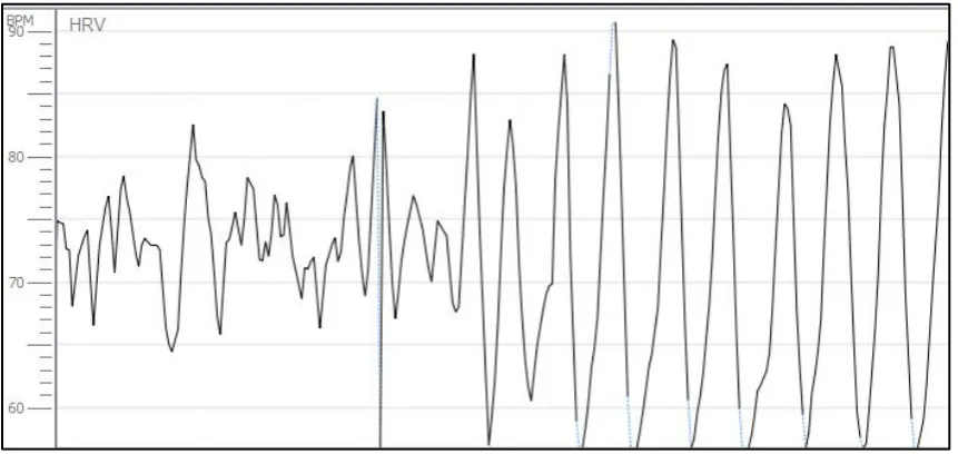 Figure 1.  Example of a Heart Rate Variability pattern becoming more coherent over time 