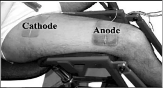 Figure 1.2: Stimulator electrode on thigh[5]. 