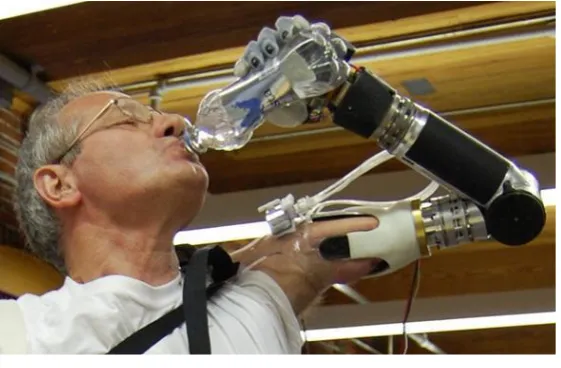 Figure 2.16: DEKA (Dean Kamen) [2] 
