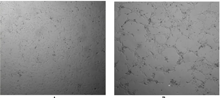Fig. 4:    Linear growth of pathogenic bacteria after treatment with different concentrations of cobalt ferrite nanoparticle