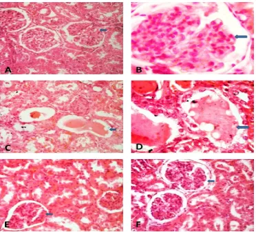 Figure 1. A, B. Transverse sections of kidney in control rat showing normal distinct 