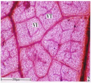 Fig -8 Venation  pattern of the lamina leaf Enlarged vein islet and termination  