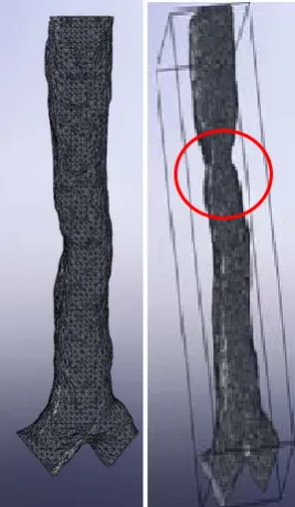 Figure 1: The extracted actual model of trachea and main bronchi from CT images. Healthy model (left) and abnormal trachea with constriction of stenosis model (right)