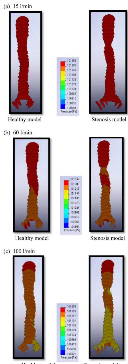 Table I: Parameters at both trachea different breathing conditions.  model for three 