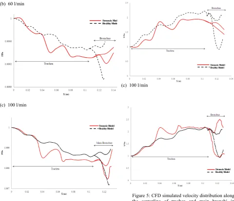 Figure 5: CFD simulated velocity distribution along the centerline of trachea and main bronchi in healthy and stenosis models at different flow rates