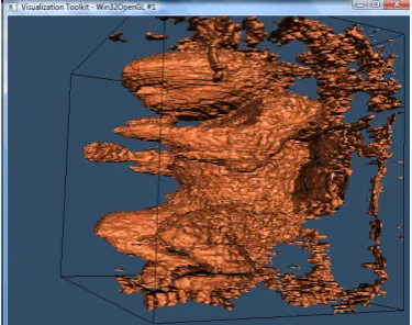 Fig.6 3D reconstruction using marching cubes algorithm   