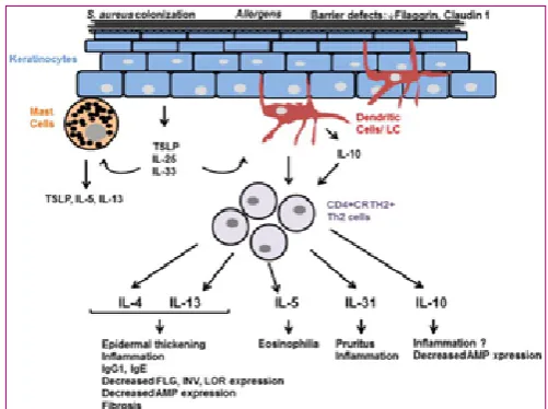 Table 1. Categories of atopic dermatitis9,10