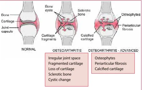 Figure 1. Joint involvement in OA