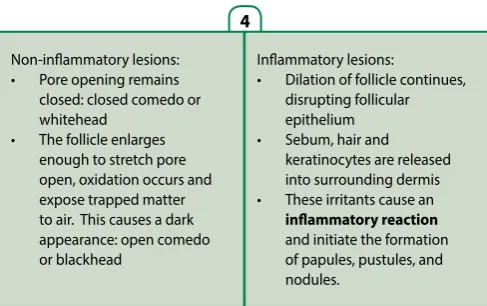 Figure 2. Basic pathogenic factors in acne2, 9, 10