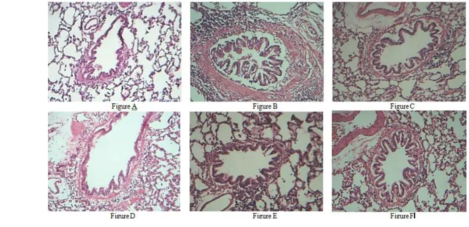 Fig. 6 : Effect of C. colocynthis and C.trigonus fruit   extracts on rat lung tissue. Figure A –normal group, Figure B- disease group, Figure C- CCE 1, Figure D – CTE 1, Figure E- CCE 2, and Figure F- CTE 2 