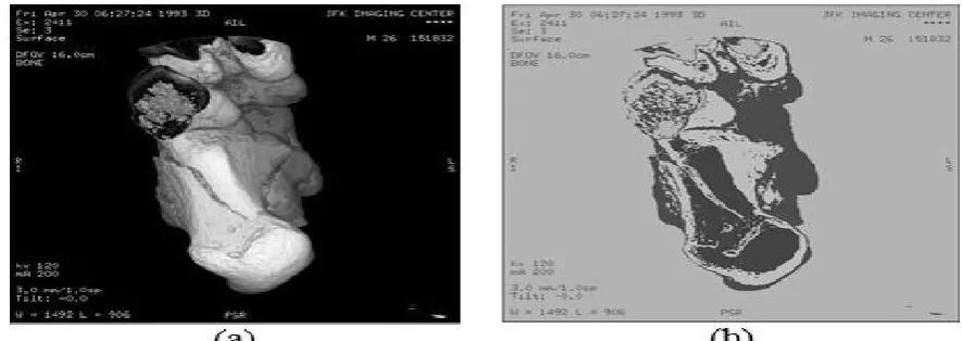Fig. 6. Figure 4. Image segmentation by k-means algorithm. (a) original image, (b) segmented image