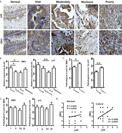 Figure 2. Quantitative analysis of EBI3 and p35 expression in colorectal cancer tissues by immunohistochemistry