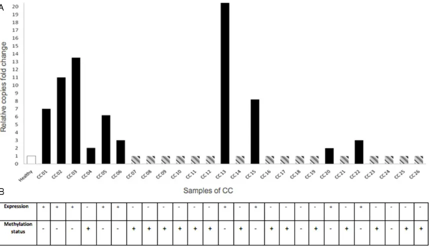 Figure 1. Molecular events for CRBP1 gene in cervical epithelium samples. A: In order to know the gain of copy number of the CRBP1 gene, DNA of healthy cervix and CC samples, were subjected to real time PCR with specific Taqman probes