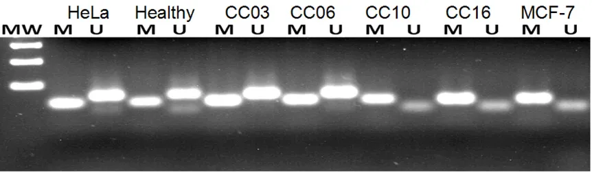 Figure 4. Methylation promoter of CRBP1 gene in cervical cancer samples. Example of CRBP1 gene promoter meth-ylation analysis