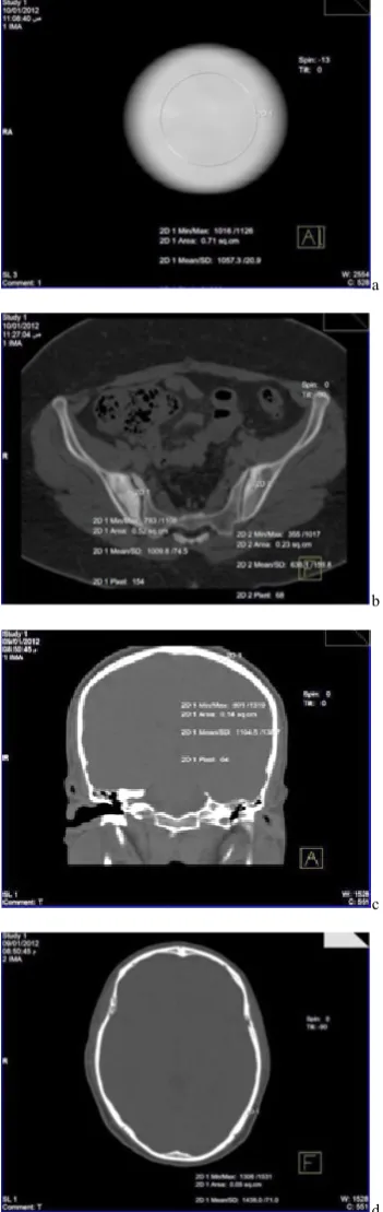 Figure 9.  The ROI of Nano Calcium Phosphate after exposure, a 1 week, b 3 weeks, c 5 weeks, d 7 weeks 