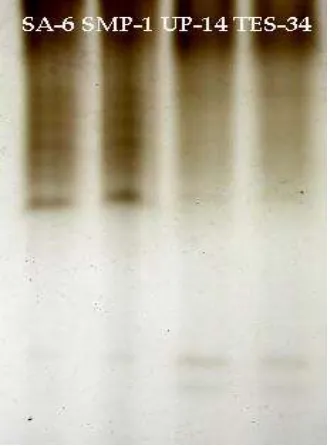 Figure 1. Isoforms of catalase native gel 