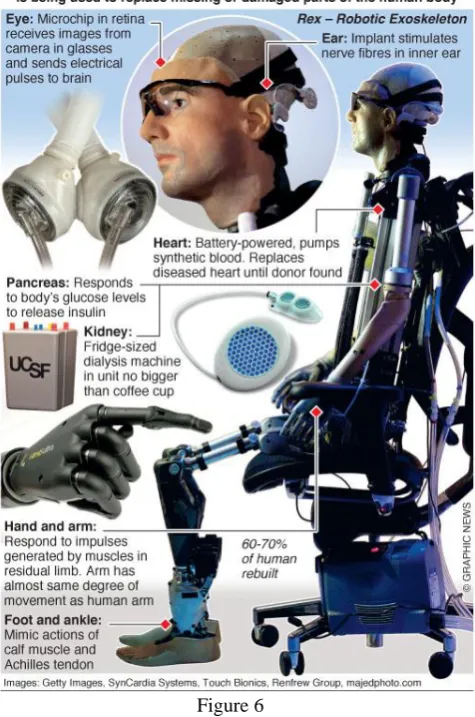 Fig.5. The man – who is called Rex – can sense objects in  front of him with retinal implants and cochlear implants to 