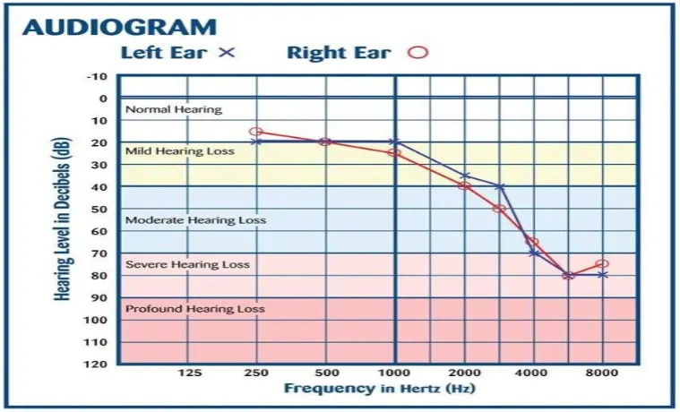 Figure 1.  Audiometric screening 