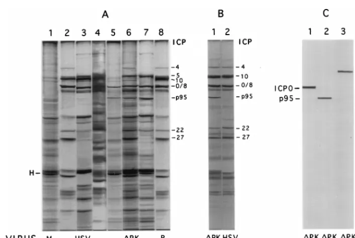 FIG. 8. Protein proﬁles of HSV-2- and ICP10�to ICP0 (lane 1), ICP10 (lane 2), or ICP4 (lane 3)