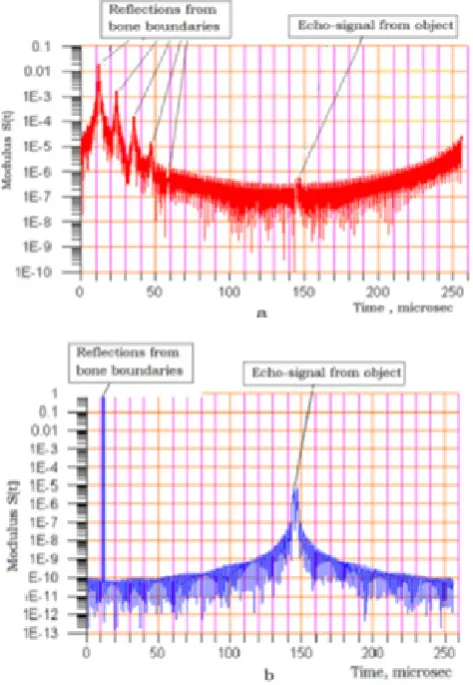 Figure.1.  Detection of useful signal. a. Standard beamforming, b. Matched filtering processing 