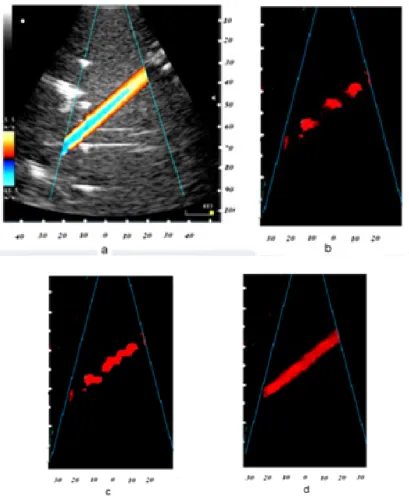 Figure 20.  Ultrasound images of flow. a. Doppler image of flow (courtesy of Medelkom LTD).Speckle images of flow at different number of iterations