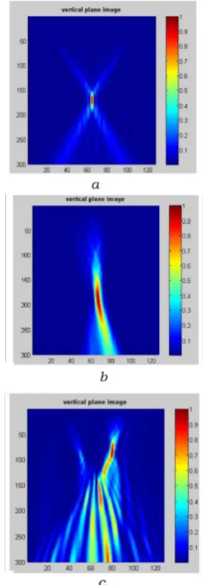 Figure 9.  Simulation of different effects in a skull bone. a. Uniform medium, bone is absent
