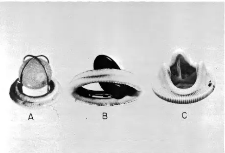 Fig 3-Three commonly used mitral valve prostheses. A. Starr-Edward Model 6120; B. Bjork-Shiley; C