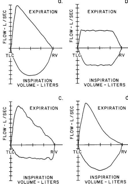 Fig 3aI co-l nspiratory-expiratory flow-volume curve shows normal nfiguration in a 28-year-old man 
