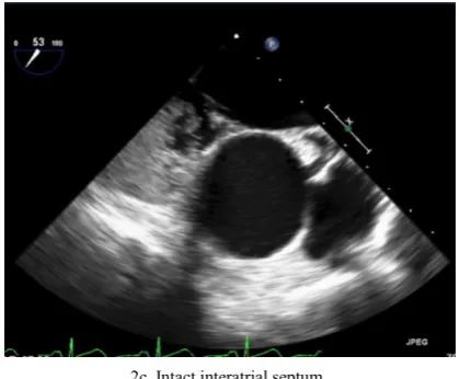 Figure 2.  Benign Findings of First Admission TEE 