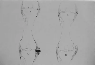 Fig I-Sequence showing degrees of sprain. A. to Athletes. C. First-degree sprain "ith minimal bleeding: B