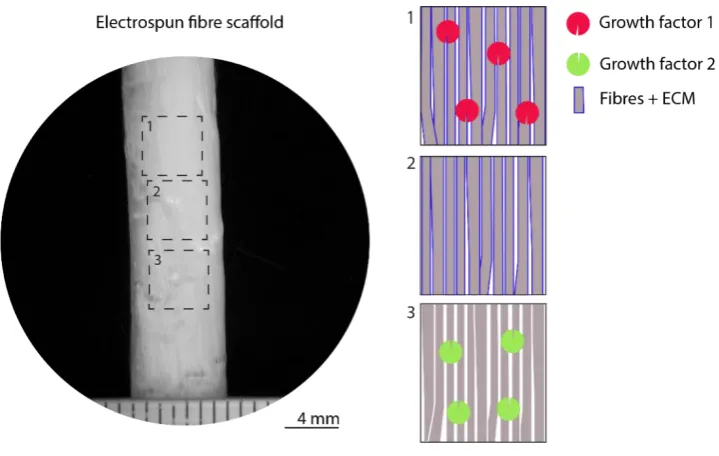 Figure 1.3 Electrospun fibre scaffold spatially functionalized with extracellular matrix (ECM) and/or growth factors within appropriate regions of the construct for (1) mineralized, (2) cartilage, (3) ligament regions