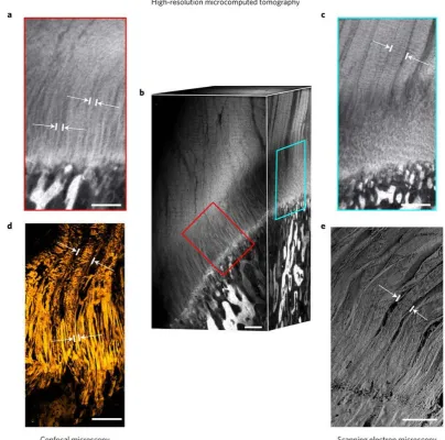 Figure 2.5 The structure of tendon and ligament fibres changes before attaching to bone