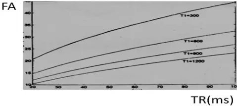 Figure 1.  Discretion blood of vessels at FA=90 using TR/TE/TH= 14/6/5 parameters is due to the trochaic effect at tight region (left and middle images).Increasing of TR for 25 and reduction of FA to 60 degree at tight region the discretion of the vessels 