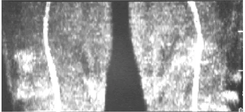 Figure 2.  The best view signals were obtained at 90 angle deviation. At knee and tibia, the best rate of SNK CNR and the diagnostic value score using TR=35 were obtained