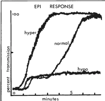 Fig. 2-Measurement aggregation of the rate and degrees of platelet by mechanized instrumentation