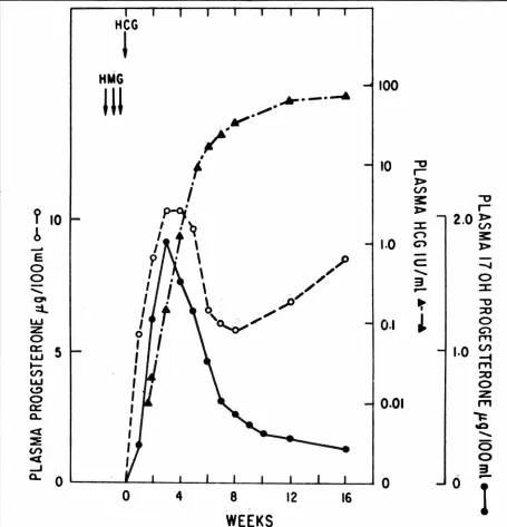 Fig. 4- Mean plasma levels of and subsequent conception. (Reprinted with permission from Yoshimi, progesterone, 17-hydroxyprogesterone, and HCG following induction of ovulation with HMG-HCG et al