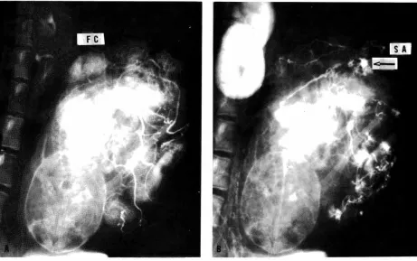 Fig. 9- Spot (SA) (Reprinted films made during a combined fetal and maternal injection study