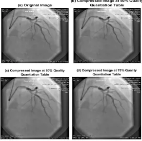 Table 1: Image sizes after different level of compression with Quality Quantization Tables (QQT) 