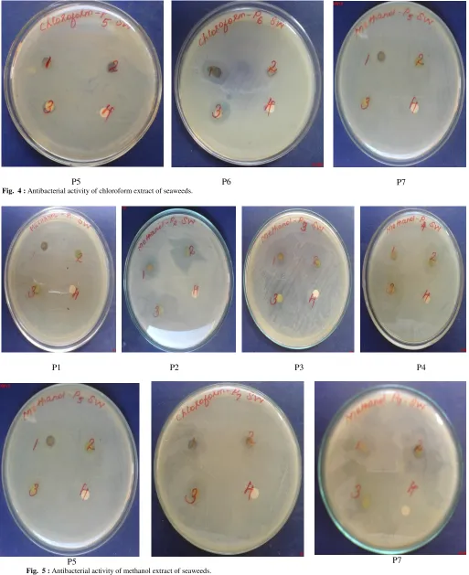 Fig.  4 : Antibacterial activity of chloroform extract of seaweeds. 