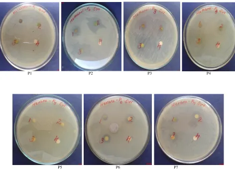 Fig. 6 : Antibacterial activity of hexane extract of seaweeds.  