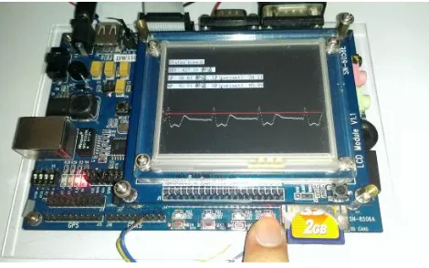 Figure 7.  The white ECG signal is shown in the touch panel of the embedded system. 