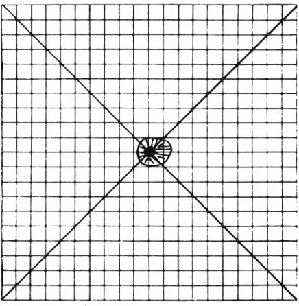 Fig 3-Dense OU. central scotoma approximately 0.5 degree in diameter with bluish outer edge and a whitish halo of about 1 degree